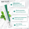 Крем для видалення шрамів і рубців від висипу вугрів Breylee Acne Scar Removal Cream